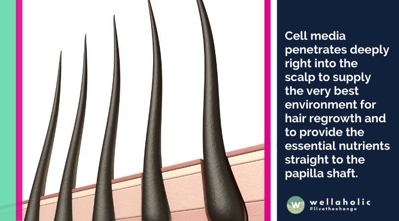 Cell media penetrates deeply right into the scalp to supply the very best environment for hair regrowth and to provide the essential nutrients straight to the papilla shaft.
