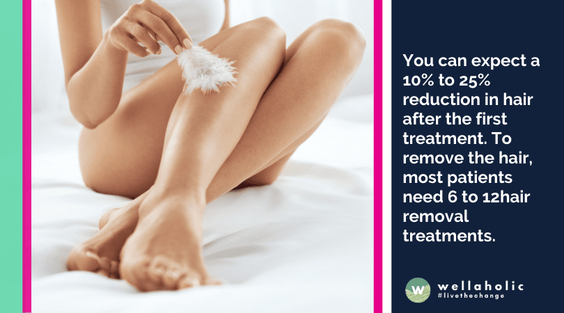 You can expect a 10% to 25% reduction in hair after the first treatment. To remove the hair, most patients need 6 to 12hair removal treatments. 