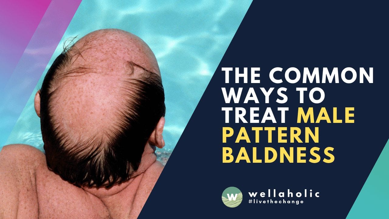 2021 Wellaholic Youtube & Website - Male Pattern Baldness