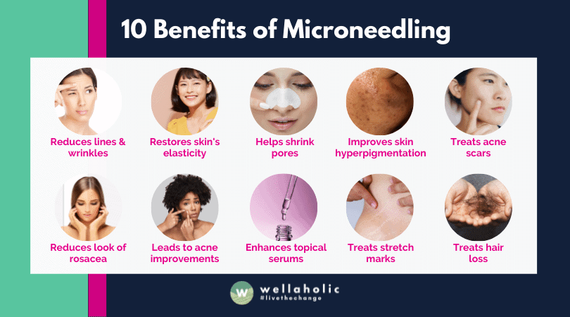  10 benefits of microneedling