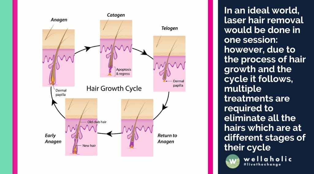 In an ideal world, laser hair removal would be done in one session: however, due to the process of hair growth and the cycle it follows, multiple treatments are required to eliminate all the hairs which are at different stages of their cycle