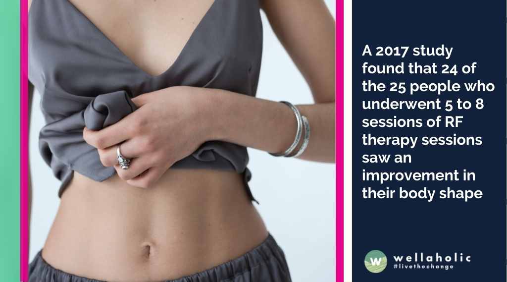 A 2017 study found that 24 of the 25 people who underwent 5 to 8 sessions of RF therapy sessions saw an improvement in their body shape