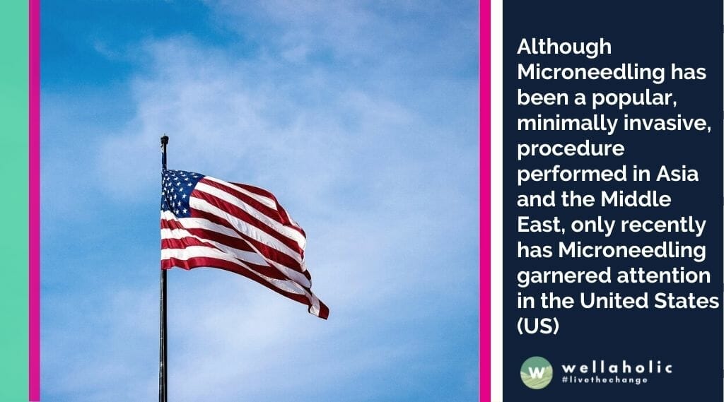 Although Microneedling has been a popular, minimally invasive, procedure performed in Asia and the Middle East, only recently has Microneedling garnered attention in the United States (US)