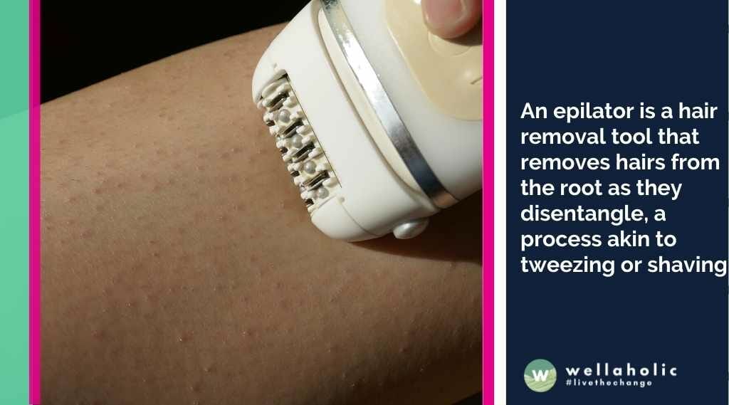 An epilator is a hair removal tool that removes hairs from the root as they disentangle, a process akin to tweezing or shaving