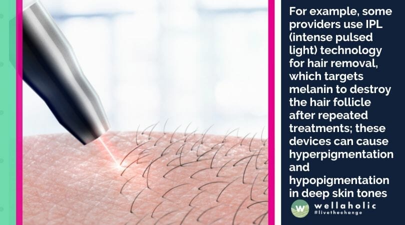 For example, some providers use IPL (intense pulsed light) technology for hair removal, which targets melanin to destroy the hair follicle after repeated treatments; these devices can cause hyperpigmentation and hypopigmentation in deep skin tones