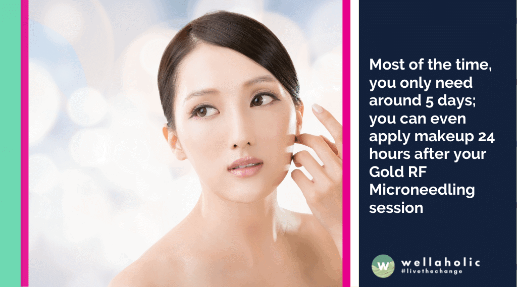 Most of the time, you only need around 5 days; you can even apply makeup 24 hours after your Gold RF Microneedling session