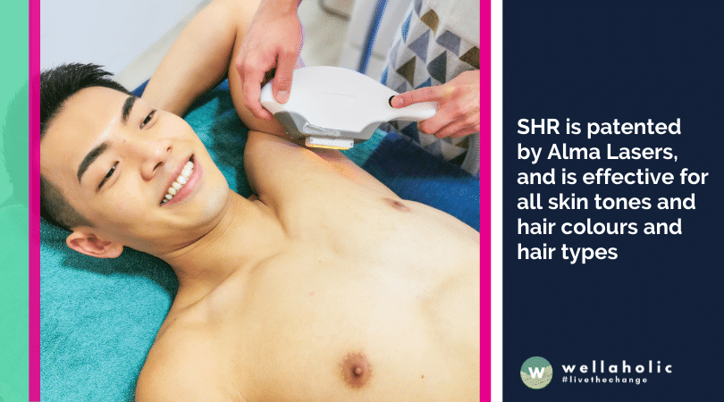 2022 Wellaholic Blog - SHR is patented by Alma Lasers, and is effective for all skin tones and hair colours and hair types