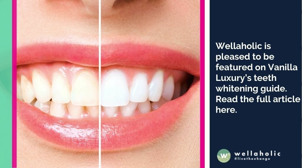 Wellaholic is pleased to be featured on Vanilla Luxury’s teeth whitening guide. Read the full article here. 