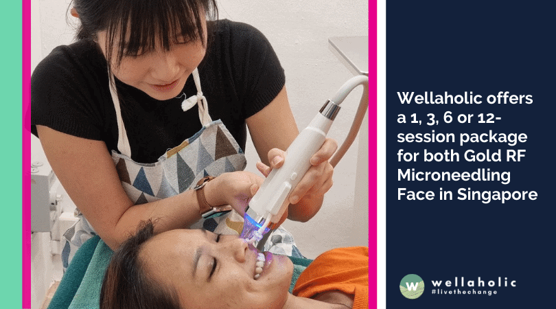 Wellaholic offers a 1, 3, 6 or 12-session package for both Gold RF Microneedling Face in Singapore: