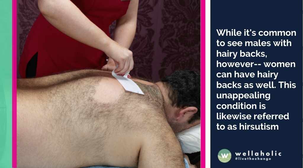 While it's common to see males with hairy backs, however-- women can have hairy backs as well. This  unappealing condition is likewise referred to as hirsutism