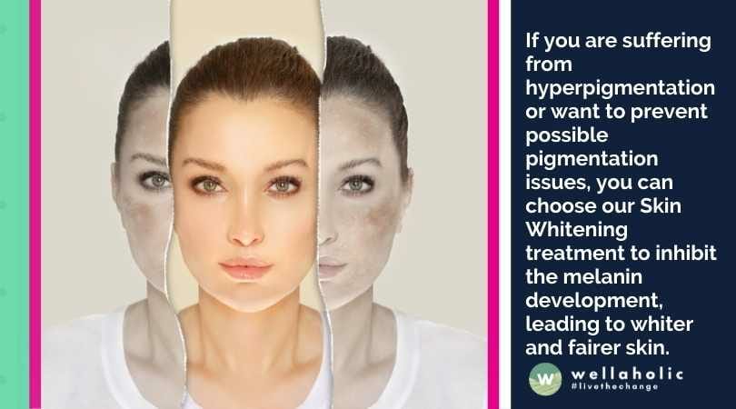 如果您正在遭受色素沉着问题或想要预防可能的色素问题，您可以选择我们的皮肤美白疗程，以抑制黑色素的生成。