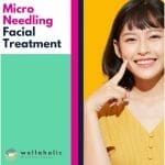 Microneedling Facial Treatment