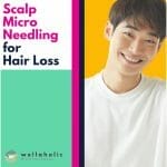 Scalp Microneedling for Hair Loss