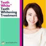 TeethWhite™ Teeth Whitening Treatment