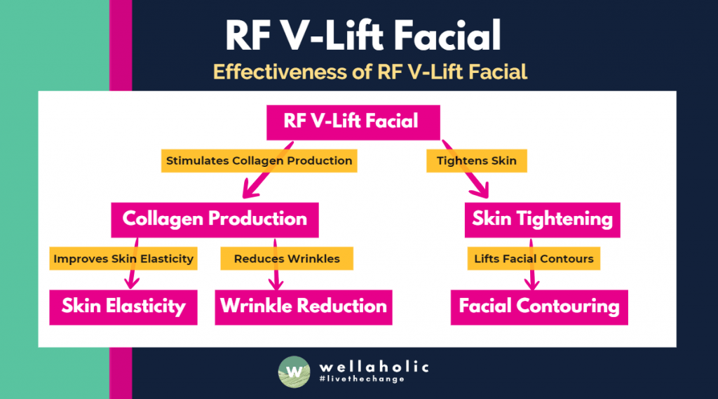 The process begins with the Radiofrequency Vlift facial treatment. This treatment stimulates collagen production in the skin. The increased collagen production leads to two main benefits: Improvement in skin elasticity. Reduction of wrinkles. Simultaneously, the Radiofrequency Vlift facial treatment also tightens the skin. The skin tightening effect contributes to the lifting of facial contours.