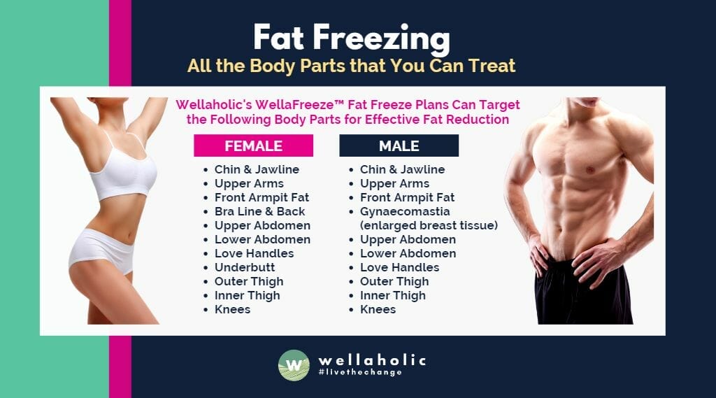  All the Body Parts for Fat Freeze