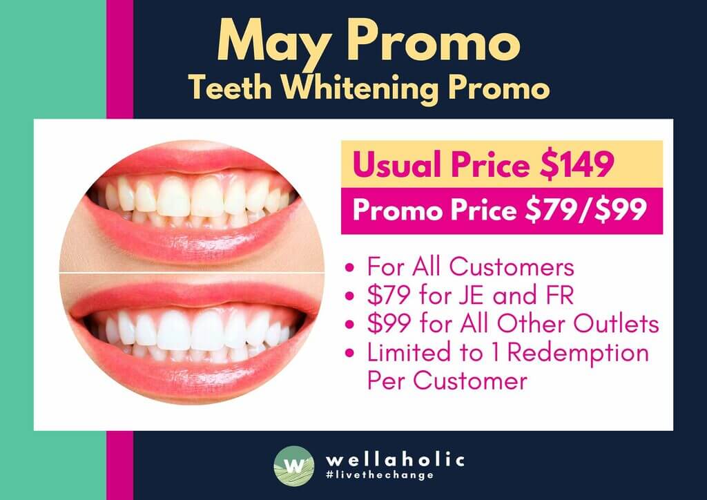 From now until May 24th, 2024, enjoy a single session of our premium Teeth Whitening treatment at just $99 (U.P. $149). That's a whopping $50 off the regular price! But wait, there's more. If you visit our Farrer Road or Jurong East outlets, you'll pay only $79 for the same incredible treatment. Talk about a steal!
