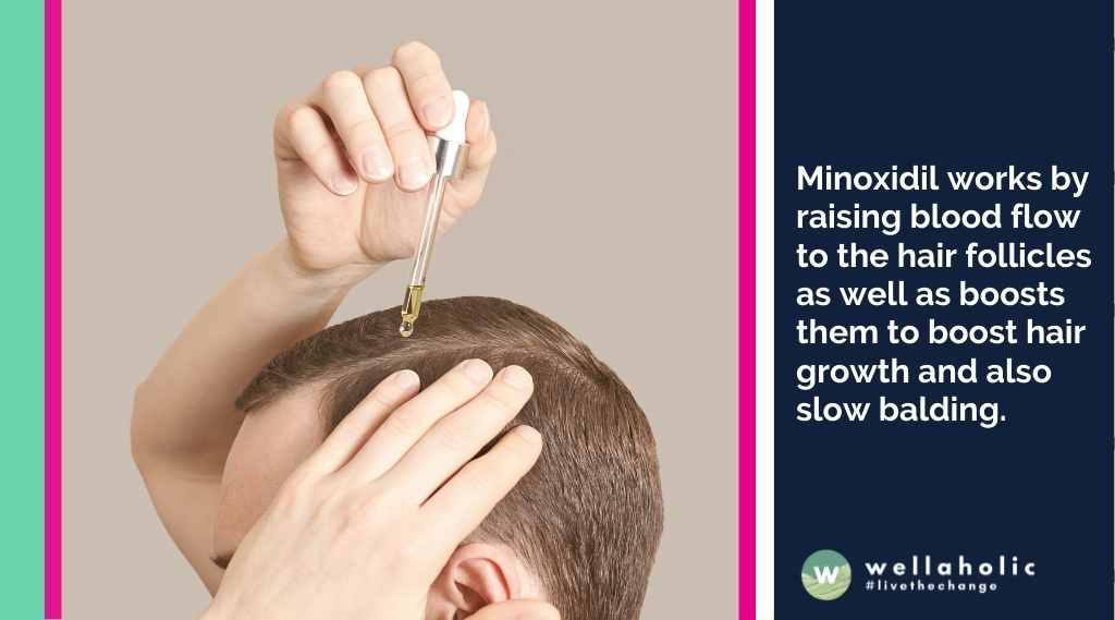 Minoxidil制剂的局部溶液、乳霜或泡沫被涂抹在受损的头皮区域。Minoxidil通过增加血液流动到毛囊，刺激它们以促进头发生长和减缓脱发。

你可以在药店购买Minoxidil的外用治疗剂，无需处方。一些报道的副作用包括使用部位瘙痒、干燥、发红和脱屑。如果症状持续或变得令人不适，请咨询你的药剂师或医生。