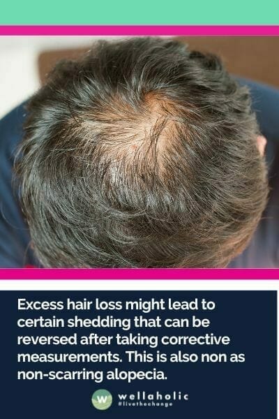 除了由遗传因素引起的脱发，脱发通常是暂时的。实际上，如果你的暂时性脱发是由怀孕、药物、身体压力、维生素、矿物质或蛋白质缺乏引起的，恢复健康后你的头发可能会恢复正常。头发应该会很快重新长出来。过多的脱发可能会导致某种脱落，但可以在采取纠正措施后逆转。这也称为非瘢痕性脱发。