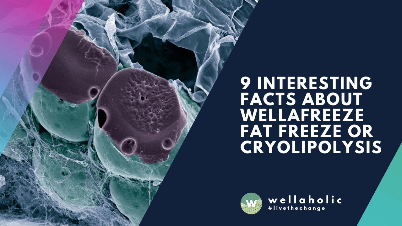 9 Interesting Facts about WellaFreeze Fat Freeze or Cryolipolysis