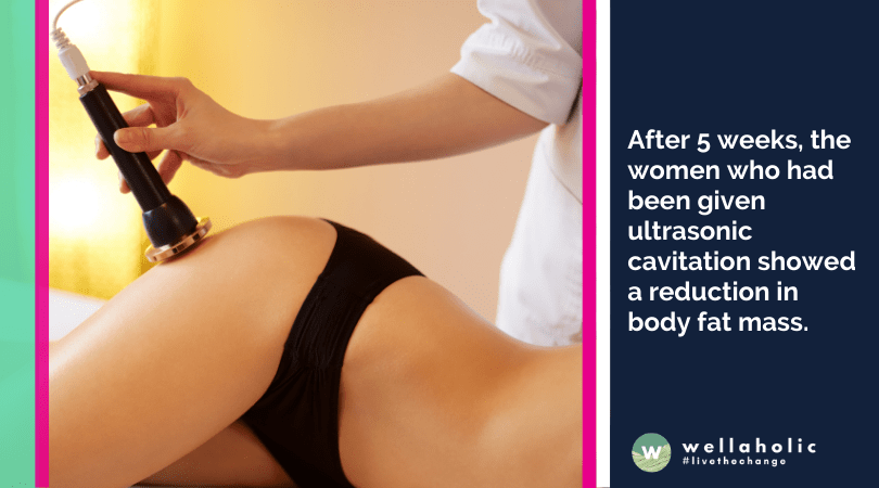 After 5 weeks, the women who had been given ultrasonic cavitation showed a reduction in body fat mass.