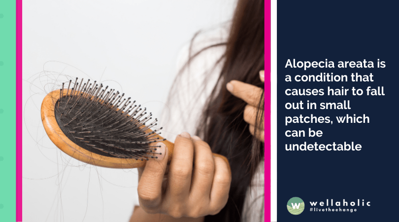 Alopecia areata is a condition that causes hair to fall out in small patches, which can be undetectable