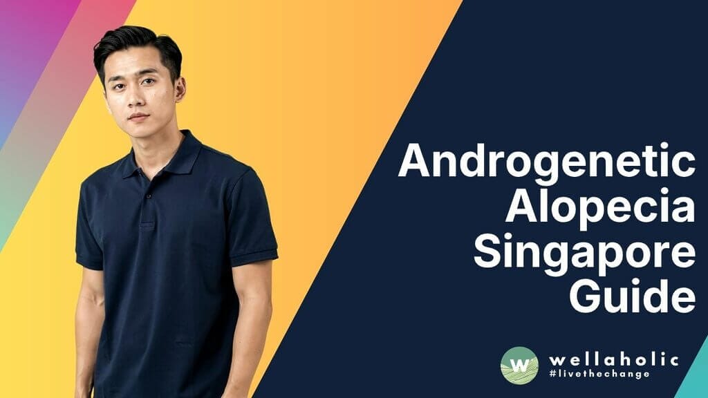 Androgenetic Alopecia Singapore Guide