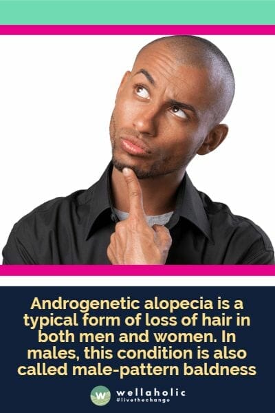 Androgenetic alopecia is a typical form of loss of hair in both men and women. In males, this condition is also called male-pattern baldness
