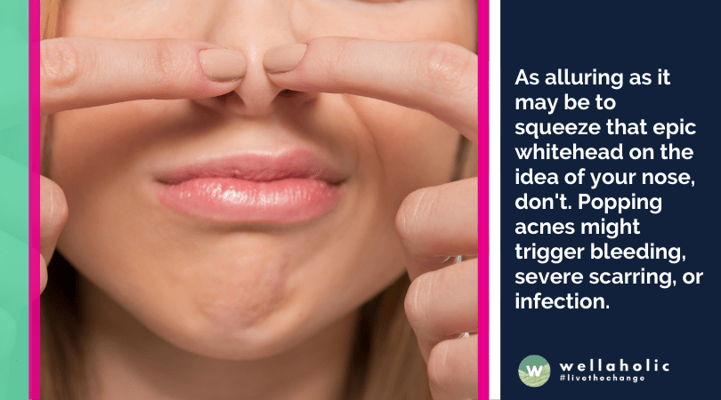 As alluring as it may be to squeeze that epic whitehead on the idea of your nose, don't. Popping acnes might trigger bleeding, severe scarring, or infection.