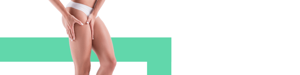 Bar - Stretch Mark 01