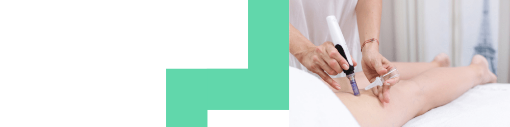 Bar - Stretch Mark 02