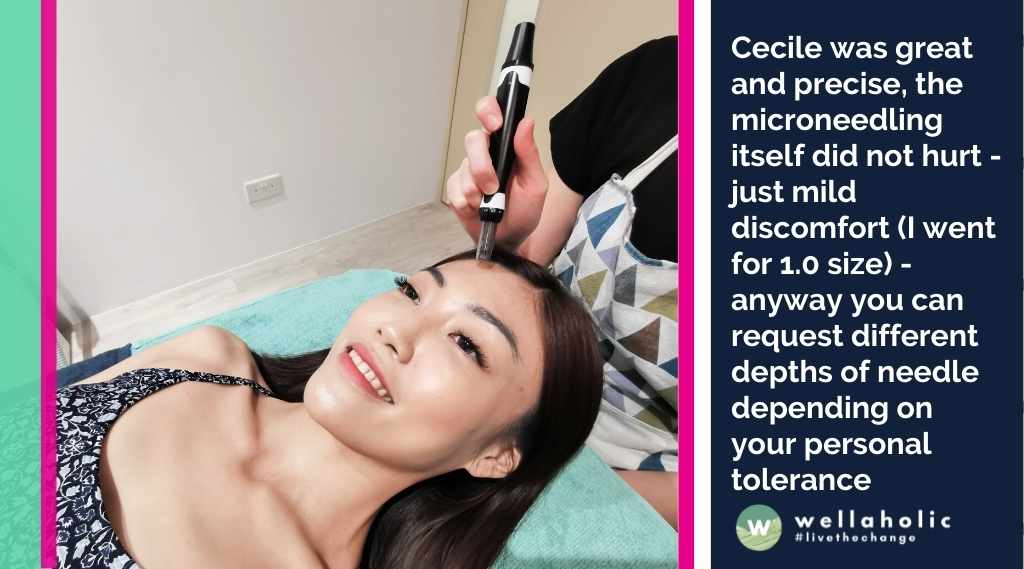 Cecile was great and precise, the microneedling itself did not hurt - just mild discomfort (I went for 1.0 size) - anyway you can request different depths of needle depending on your personal tolerance/sensitivity