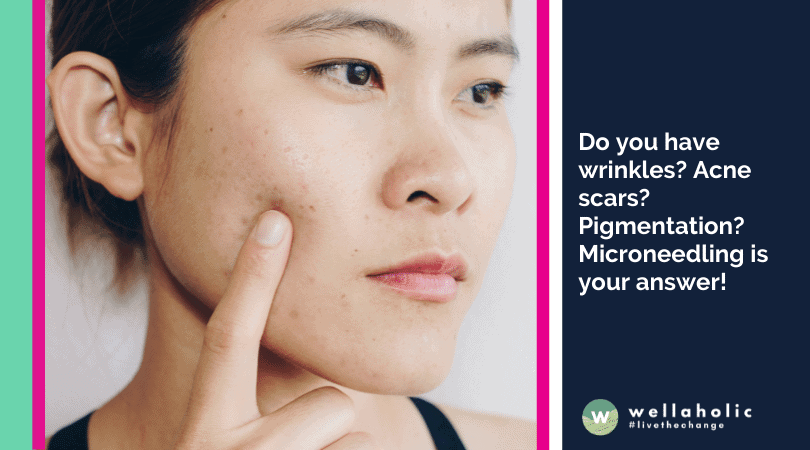 Do you have wrinkles