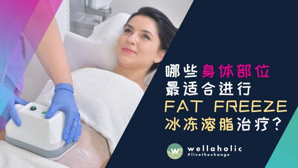 哪些身体部位最适合进行Fat Freeze冰冻溶脂治疗