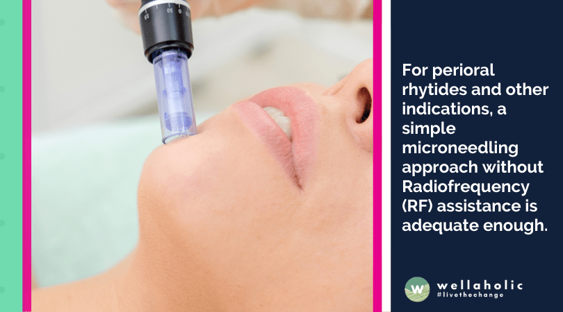 For perioral rhytides and other indications, a simple microneedling approach without Radiofrequency (RF) assistance is adequate enough.