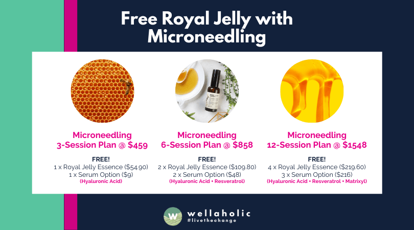 Free Royal Jelly with Microneedling