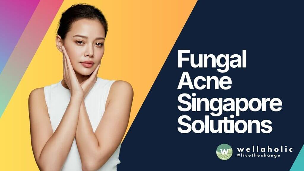 Fungal Acne Singapore Solutions