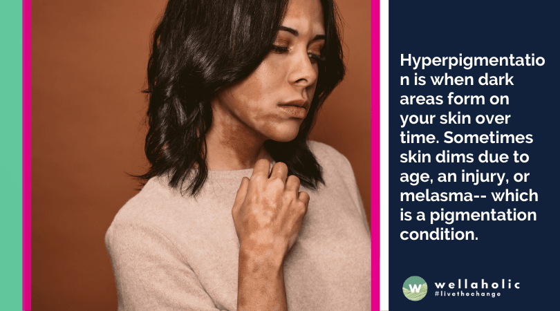 Hyperpigmentation is when dark areas form on your skin over time. Sometimes skin dims due to age, an injury, or melasma-- which is a pigmentation condition.