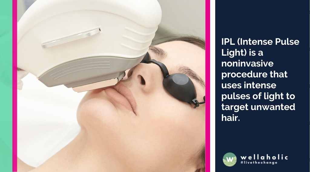 IPL (Intense Pulse Light) is a noninvasive procedure that uses intense pulses of light to target unwanted hair.