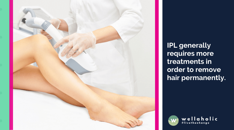 IPL generally requires more treatments in order to remove hair permanently.