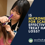 Is Microneedling for Scalp Effective to Treat Hair Loss?