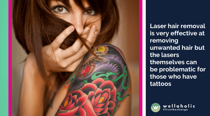 激光脱毛非常有效地去除不想要的毛发，但对于那些有纹身的人来说，激光本身可能会有问题。