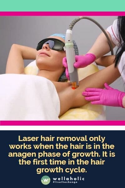 Laser hair removal only works when the hair is in the anagen phase of growth. It is the first time in the hair growth cycle.
