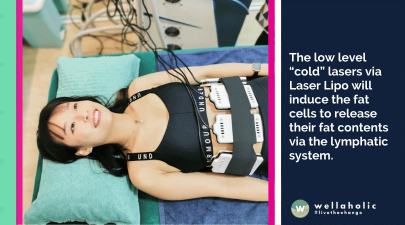 The low level “cold” lasers via Laser Lipo will induce the fat cells to release their fat contents via the lymphatic system.
