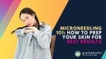 How to Prepare for a Microneedling Treatment