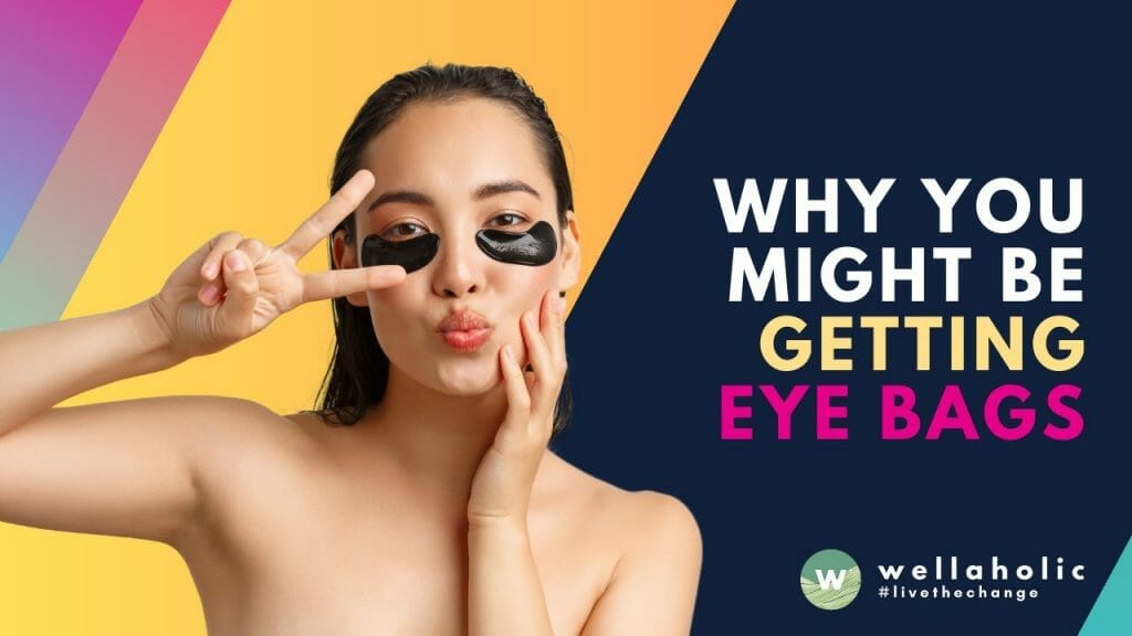 From Stress To Allergies: Why You Might Be Getting Eye Bags In Singapore