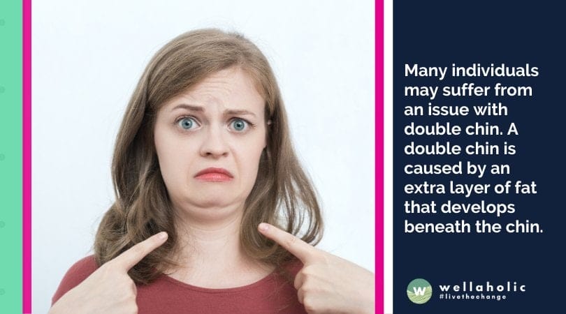 Many individuals may suffer from an issue with double chin. A double chin is caused by an extra layer of fat that develops beneath the chin.
