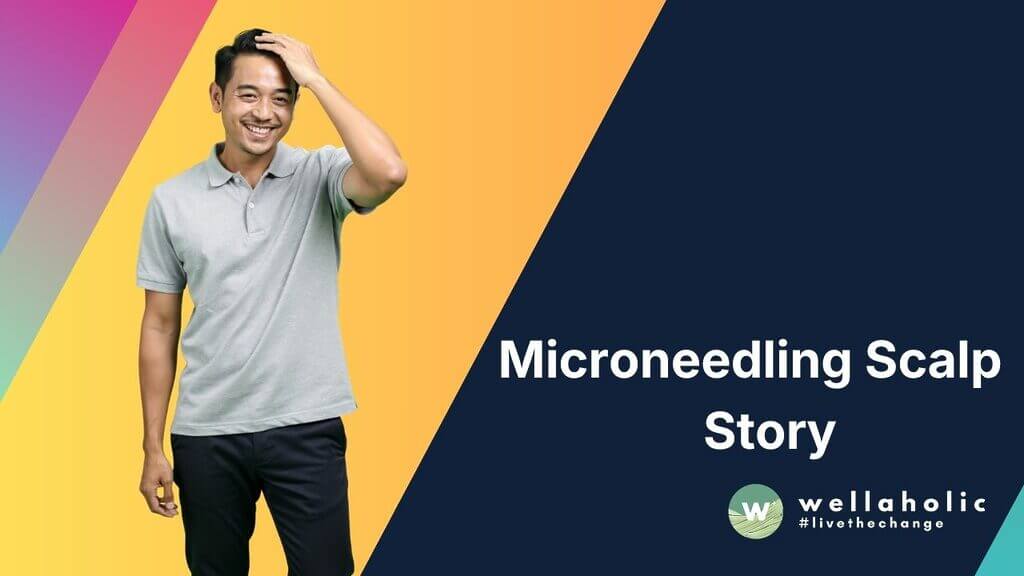 Microneedling Scalp Story