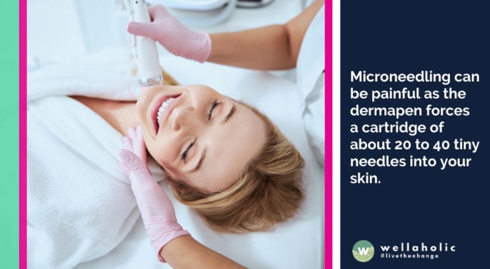 Microneedling can be painful as the dermapen forces a cartridge of about 20 to 40 tiny needles into your skin.