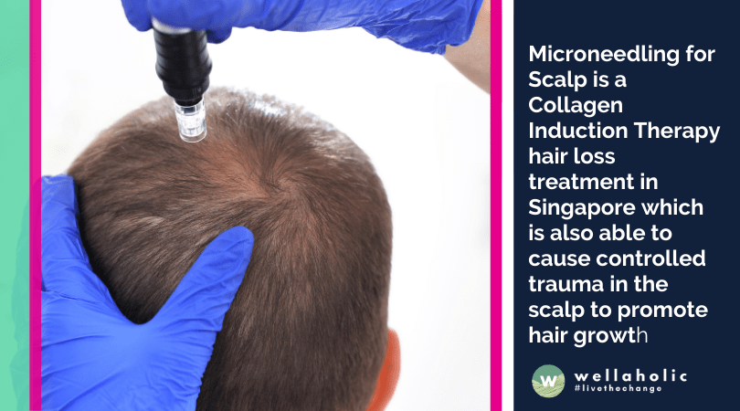 Microneedling for Scalp is a Collagen Induction Therapy hair loss treatment in Singapore which is also able to cause controlled trauma in the scalp to promote hair growt